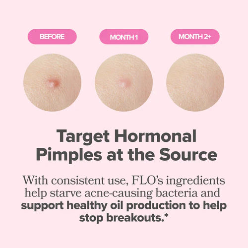 Hormonal Acne Vitamin Capsules